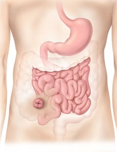 a stomach