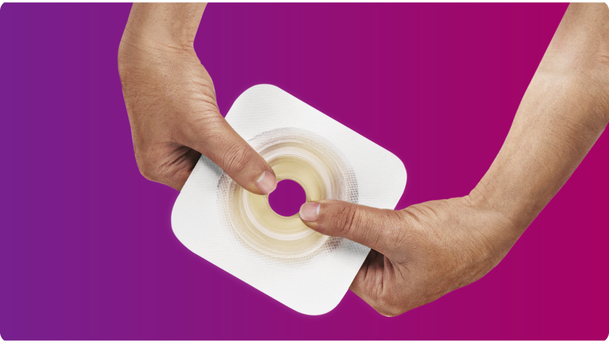 Convatec Mouldable Technology 베이스 플레이트를 들고 있는 손