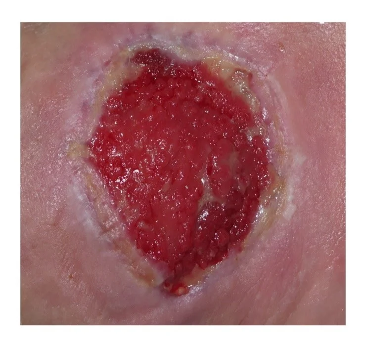 un primer plano del pecho de una persona