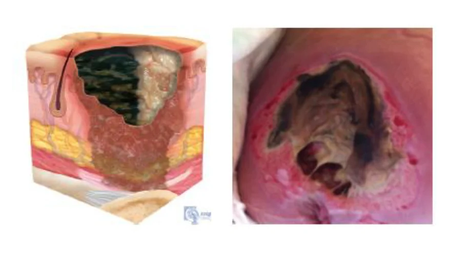 un perro acostado en una cama