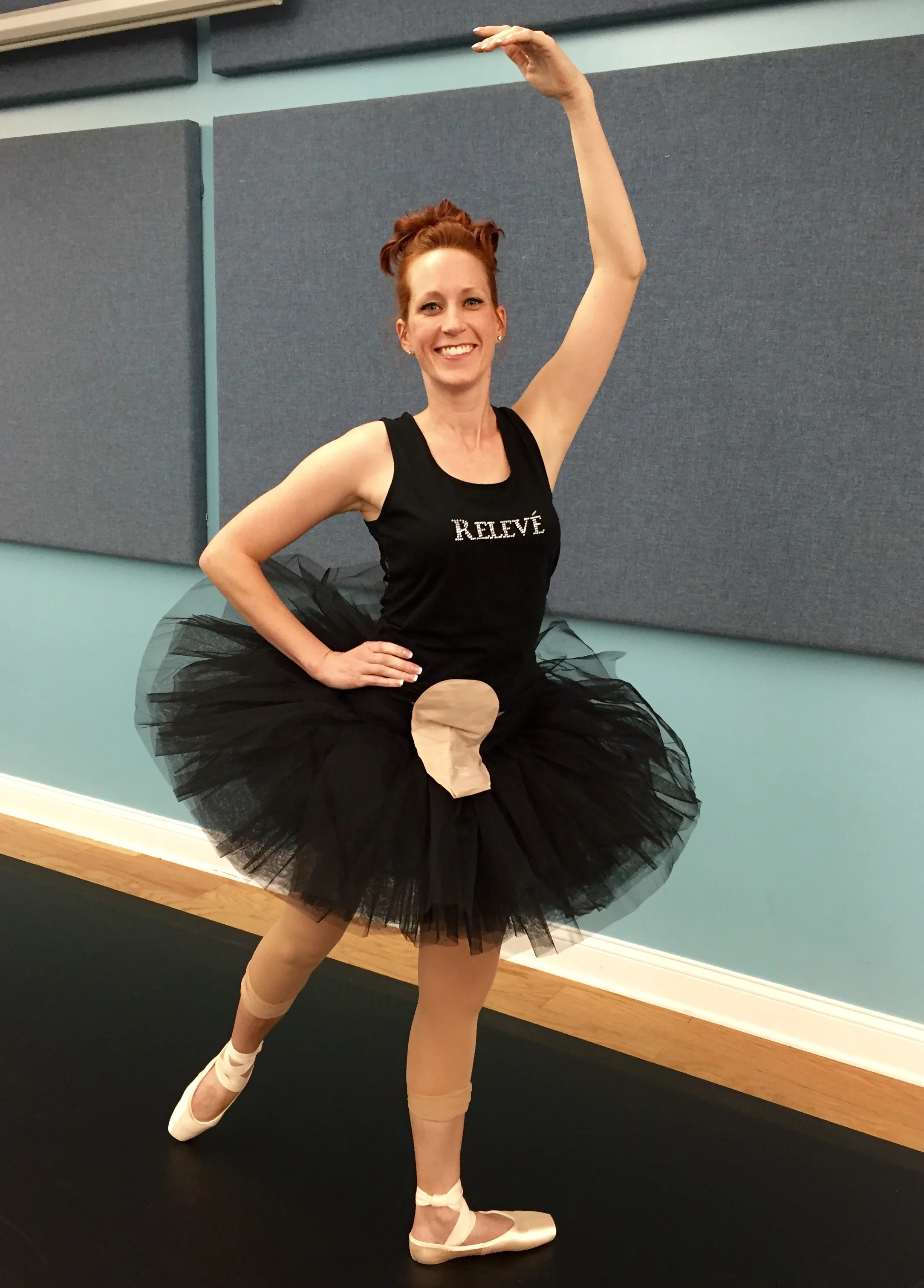 Ballet dancer with an ostomy pouch