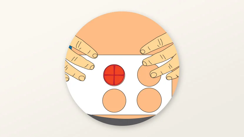 Illustratie van het meten van een stoma