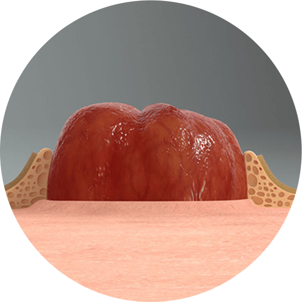 LEAK-LOCK™ 시스템 클로즈업