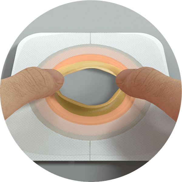 베이스 플레이트의 클로즈업