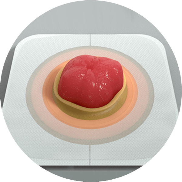 베이스 플레이트의 클로즈업