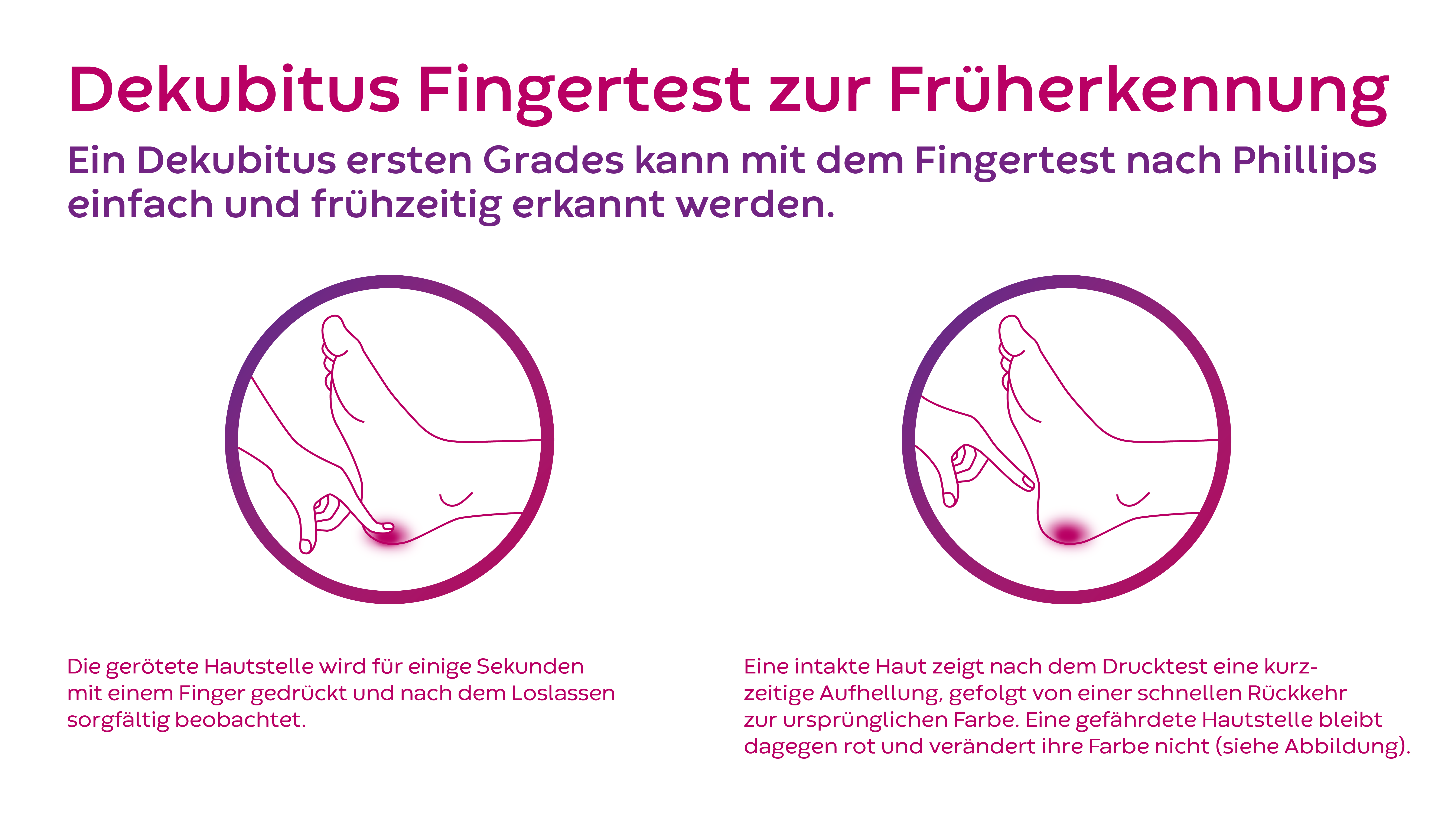 Dekubitus Test zur Fr&uuml;herkennung nach Philips